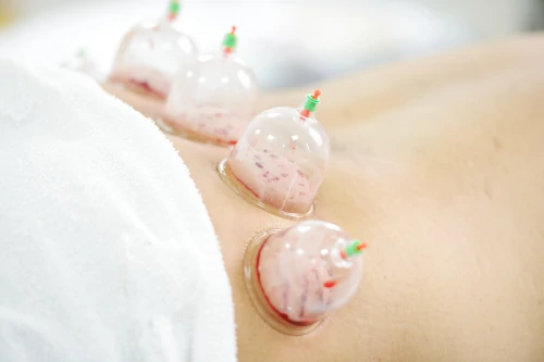 Hijama Services